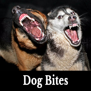 DogBites